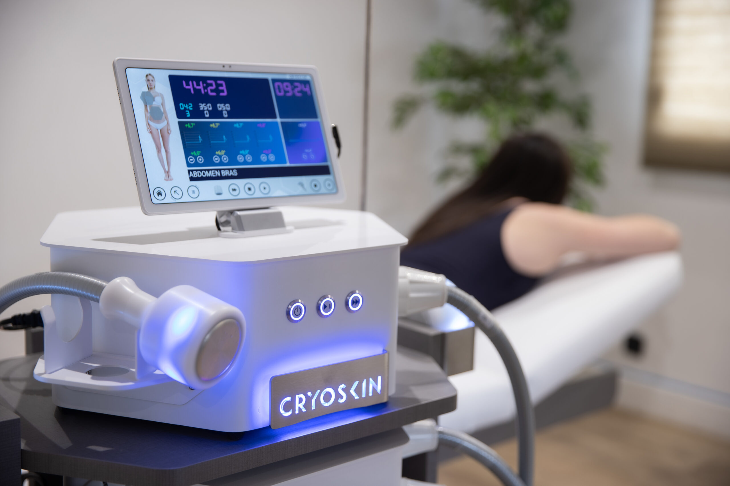 Het Cryoskin apparaat in een praktijk: Moderne cryolipolyse in actie