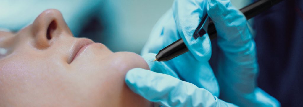 stylet-demo-1500-1024x363